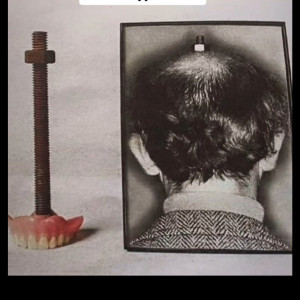 와들와들 1930년대 외과수술 수준