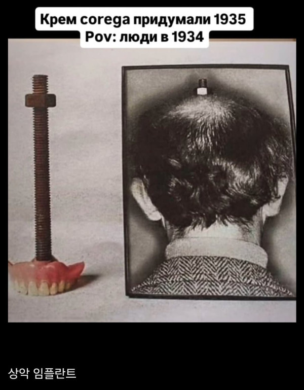와들와들 1930년대 외과수술 수준