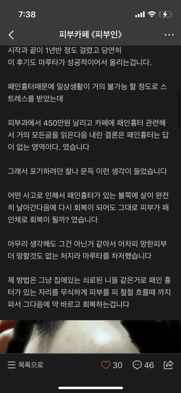 여드름 피부 유일한 해결책ㄷㄷㄷ